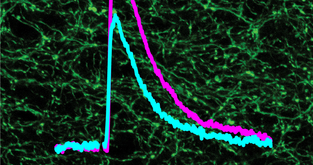 A New Target for Improving Movement Symptoms of Parkinson’s Disease