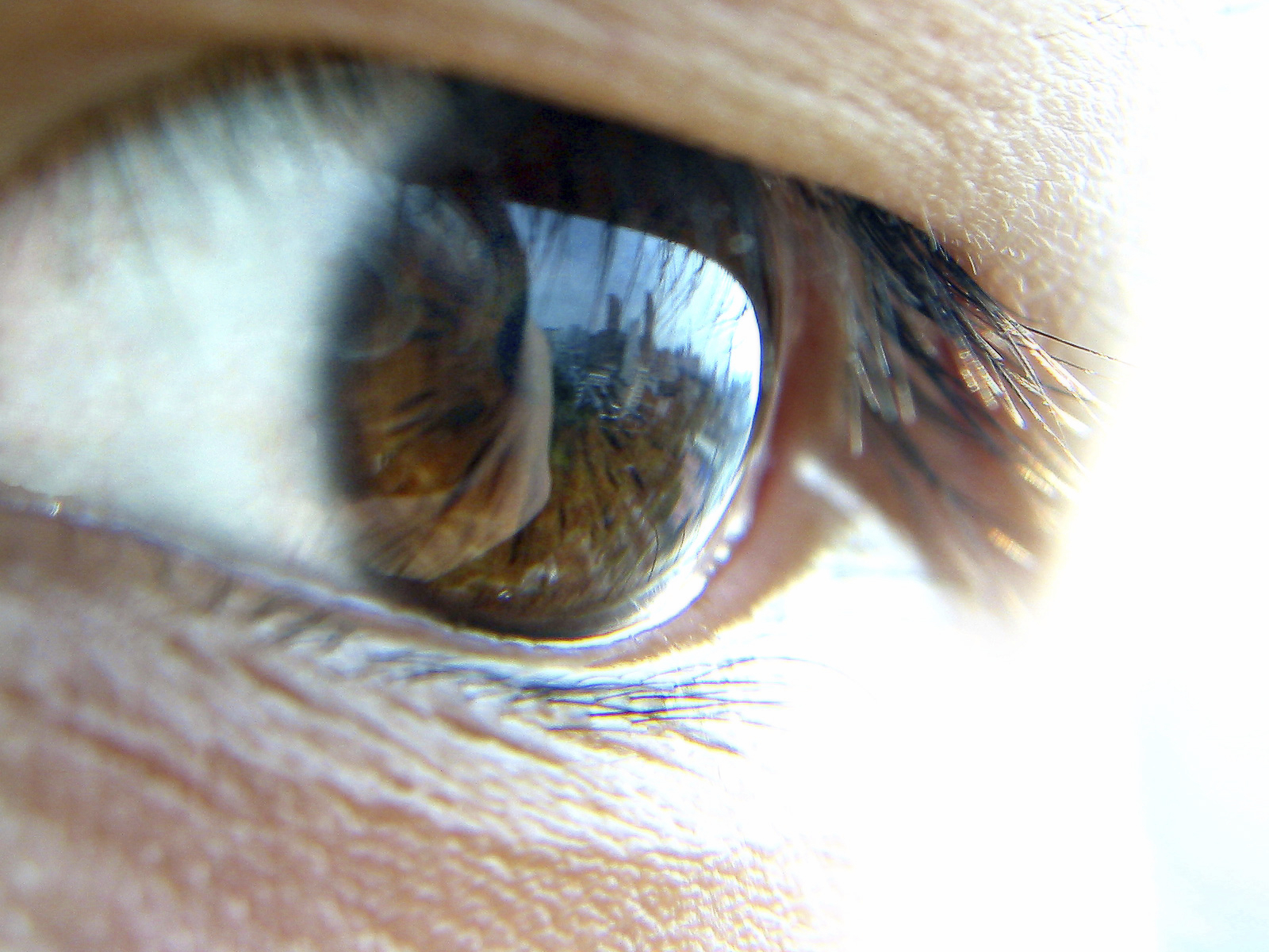 A new treatment for glaucoma?