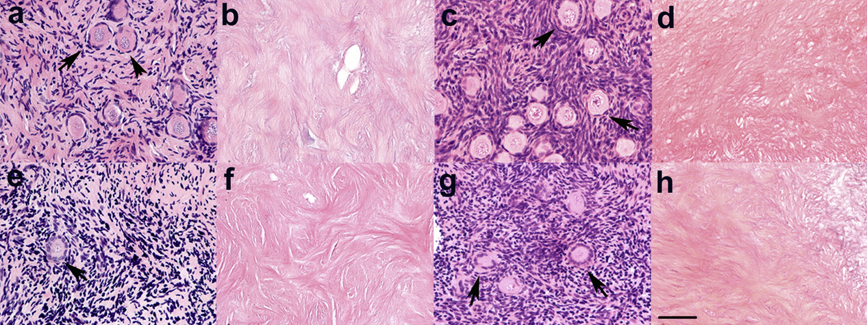 Ovary Transplantation Shows Promise for Restoring Cancer Survivor Fertility