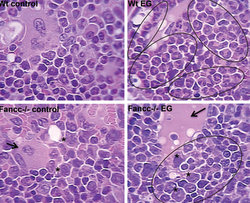 Discovery May Aid Treatment of Rare Blood Disorder