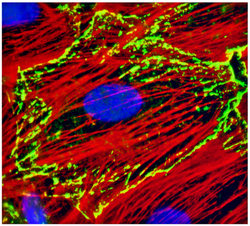 Cohesion Protein May Play Role in Gene Expression