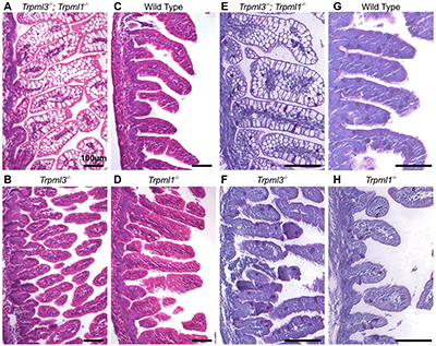 Lysosome Dysfunction Linked to Infant Failure to Thrive