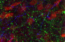 Shedding New Light on Brain Circuit Involved in Parkinson’s