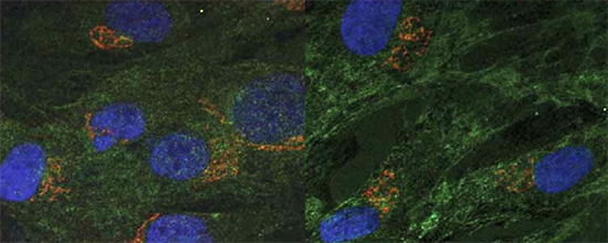 Tracking HIV to the Cell Nucleus