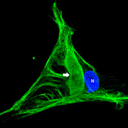 Rare, Lethal Childhood Disease Tracked to Specific Protein