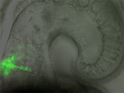 Genes Revealed that May Impact the Colonization of Beneficial Bacteria