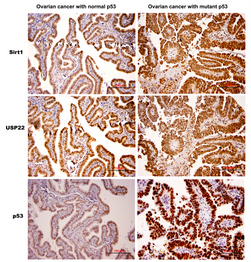 Mechanisms Behind Cancer Causing Gene Revealed