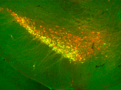 Disentangling the Dopaminergic System