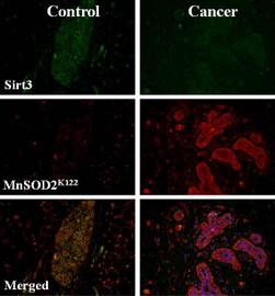 Gene Shown to Regulate Cell Recovery from Stress