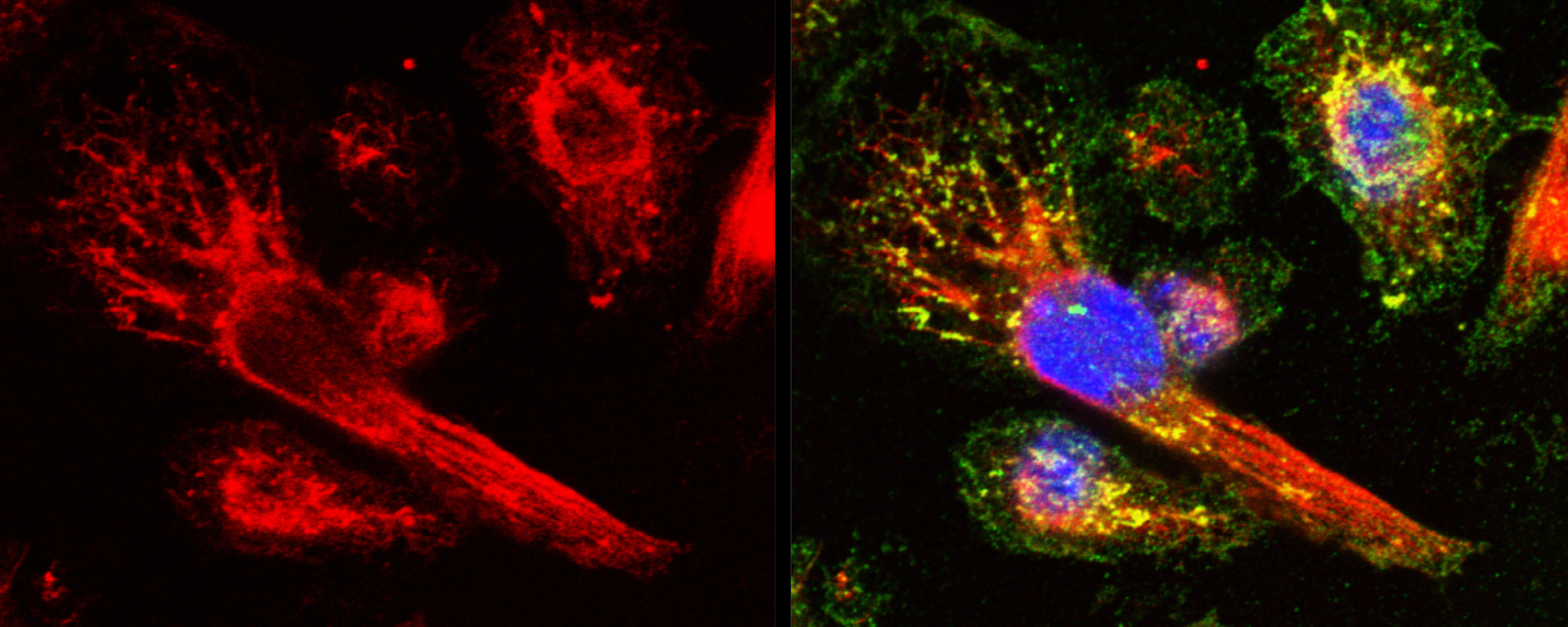 Vimentin Implicated in Lung Inflammation and Fibrosis