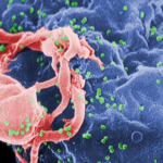 Tumor-Like Tissue Environments Could Hold Clues to Curing HIV