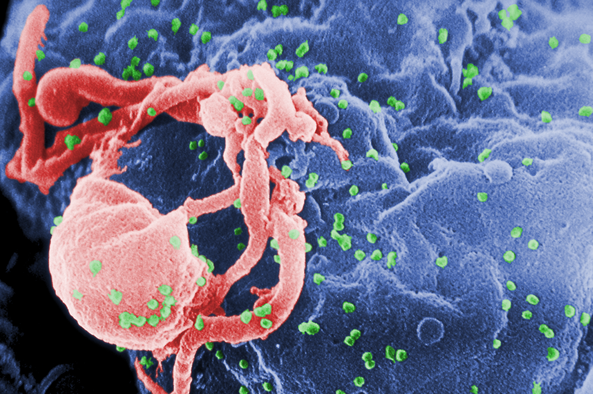 Creating a one-stop shop for HIV research