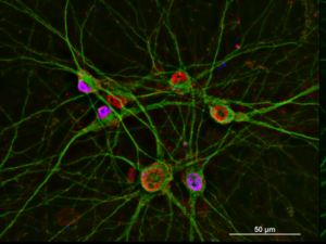 Patient Neurons