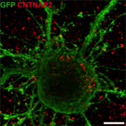 CNTNAP2 neurons-cropped-250
