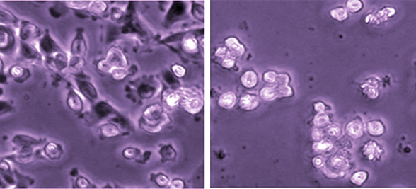 Bacterial Sepsis Protein May Inhibit Cancer Cell Growth