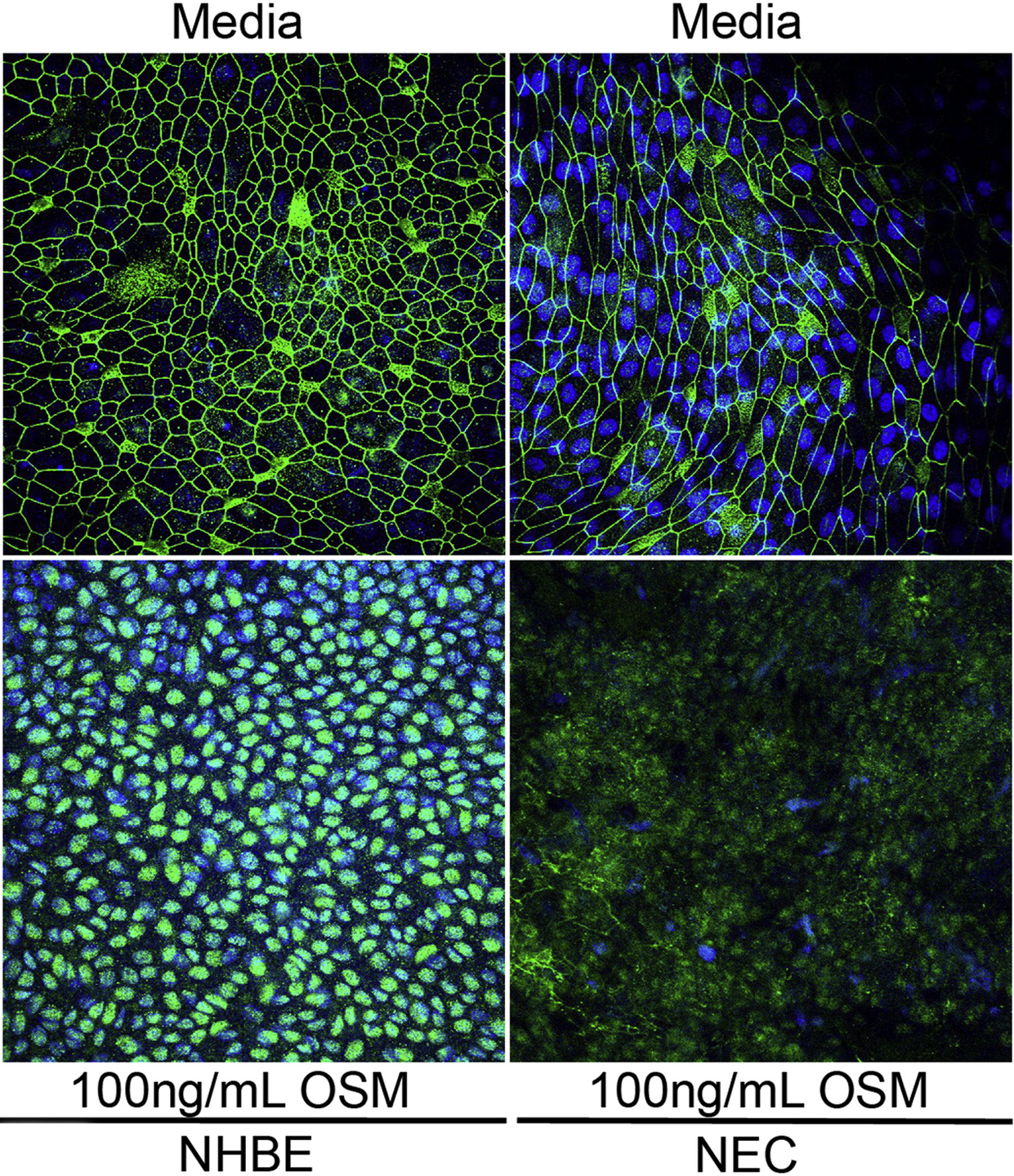 Mechanism Behind Asthma and Chronic Rhinosinusitis Proposed