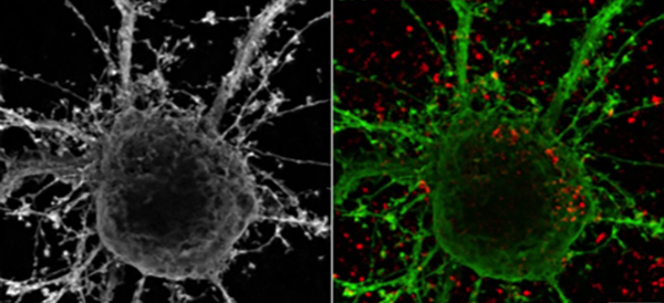 Synapse Abnormalities Shed Light on Psychiatric Disorders