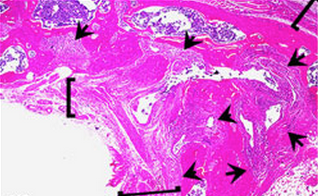 Investigating the Roots of Rheumatoid Arthritis