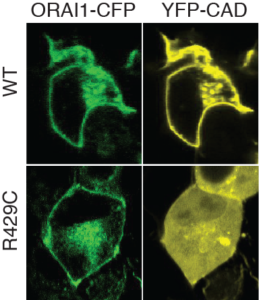 This image shows the calcium ion channel (ORAI1-CFP), wild type and mutant (R429C) expressed in cells. This mutation in the calcium ion channel leads to an immunodeficiency syndrome. 