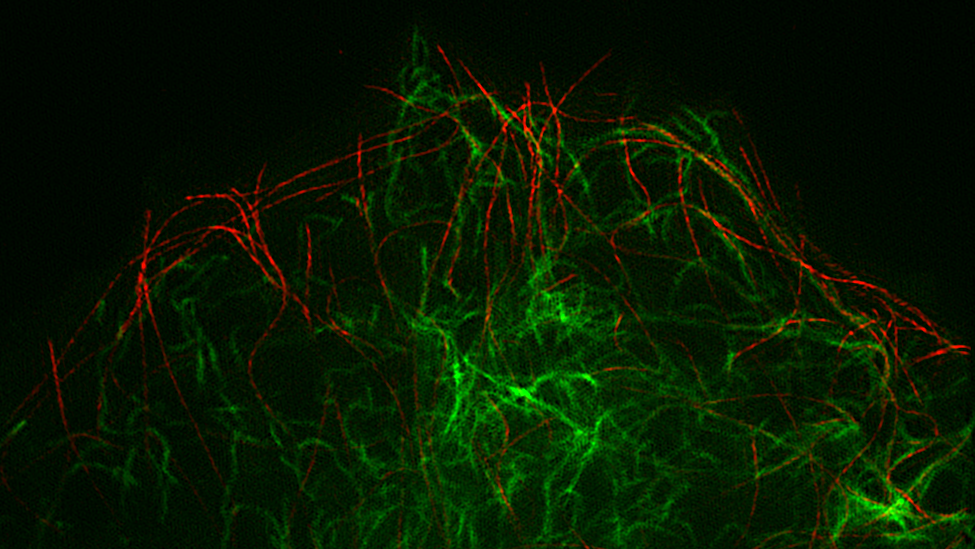 Vimentin intermediate filaments (green), responsible for the mechanical support of cells, are organized by their transport along microtubules (red). Northwestern Medicine scientists used images like this, acquired using super-resolution microscopy, to discover and measure vimentin filament transport.