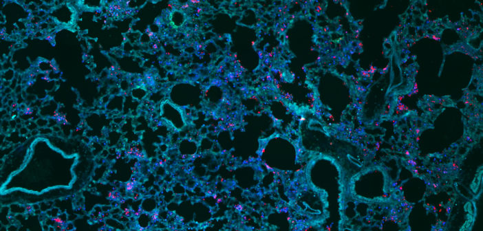 mouse lung with pseudomonas aeruginosa pneumonia