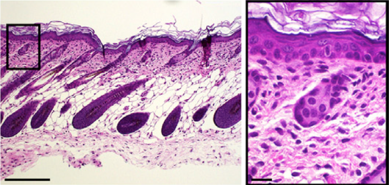 Protein Found to Control Inflammatory Response