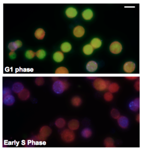 Both Cdt1 (green) and p21 (red) are present in the nuclei of cells in the G1 phase. While Cdt1 already underwent degradation in the early S phase, p21 was still detectable in the nuclei at this stage. Cells undergoing active DNA replication in the S phase were identified by BrdU (blue) staining.  