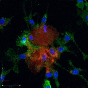 Immune cells called macrophages (green) swarm to dying heart cells (red) in this image featured on the cover of the Journal of Molecular and Cellular Cardiology.