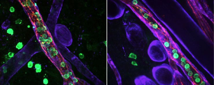 Tracking White Blood Cell Migration