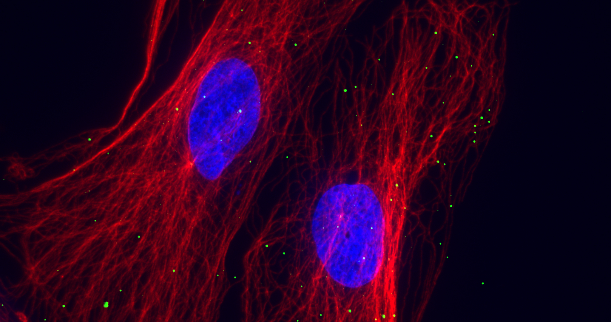 Tracking How Herpes Simplex Virus Moves Through Cells