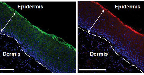 Blocking Sodium Channel Helps Skin Heal