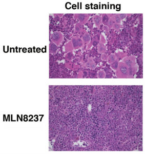 Image shows bone marrow in an animal model of myelofibrosis with and without MLN8237 therapy. Hematoxylin/eosin staining reveals an abundance of atypical bone marrow cells in the untreated mouse that are absence in the MLN8237 treated mouse.