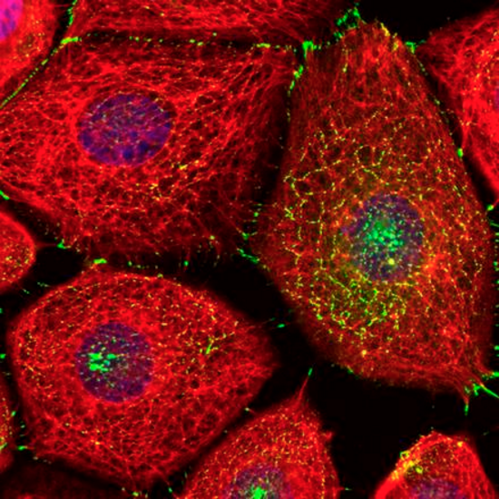 A mutation in desmoplakin (green) delays assembly of the intermediate filament cytoskeleton (red) at cell-cell junctions.