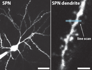 The study showed that nitric oxide decreases the strength of communication between some neurons, including striatal projection neurons (one is shown at left, with a close-up of its dendrite at right).