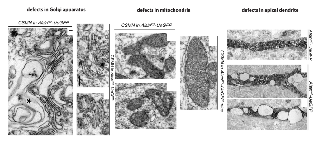 In the absence of alsin function, upper motor neurons display many cellular defects, including defects in their mitochondria and Golgi apparatus and disintegration of apical dendrites.
