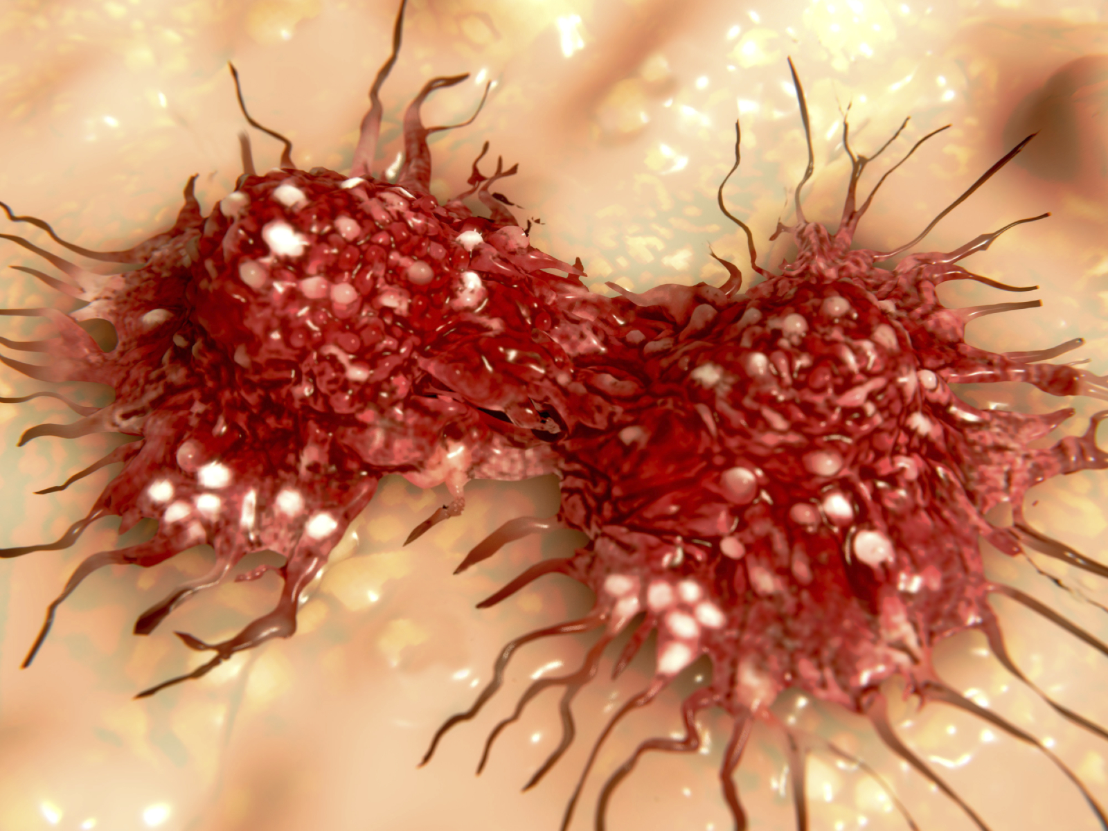 Discovery Could Improve Survival of Bladder Cancer Patients