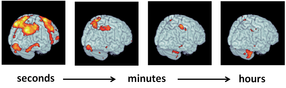 Different regions of the brain are associated with these short and long-term timescales of motor memory in the recent study.