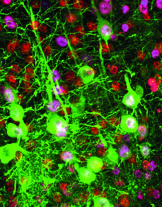 The study showed that upper motor neurons (green) can be transduced without affecting other cells in the motor cortex, an important achievement for future translational efforts.