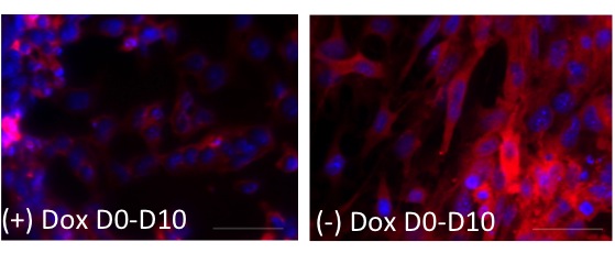 Immunofluorescent staining shows that the protein expression level of the gene myosin heavy chain isoform (red), which allows muscle contraction, is increased in cardiomyocytes expressing high levels of Foxc1 (left), when compared to normal levels of Foxc1 (right). 