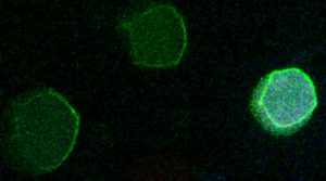 This image shows a mutated cell (far right) that has lost its cell polarity when the kur gene was disrupted, compared to two normal cells (left).