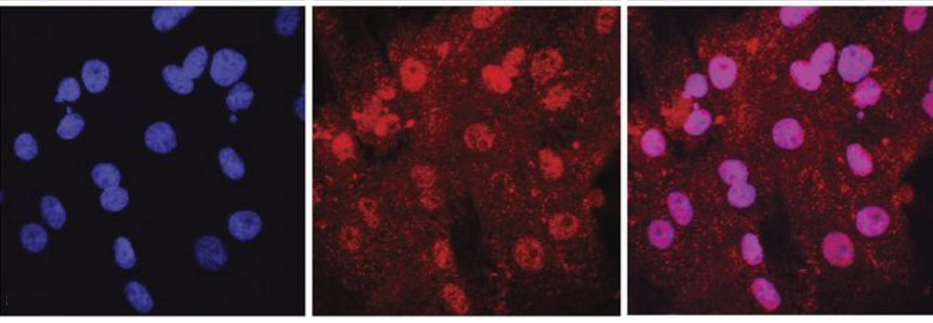 Decoding Signaling Pathways that Lead to Scar Tissue