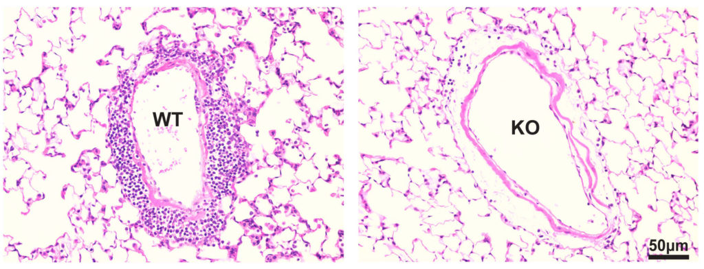 This image shows large pulmonary vein inflammation in the wild-type mice (left) compared to the knockout mouse lacking the αT-catenin gene.
