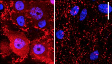 Rescuing Damaged Neurons in Parkinson’s Disease