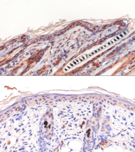 The scientists analyzed expression of transcription factor proteins called hypoxia-inducible factors in wild-type mice (top) and mice with mitochondrial deficiency in their skin (bottom). These proteins cause blood vessels in the skin to widen as part of a chain of events that occur when mammals respond to inadequate oxygen supply.