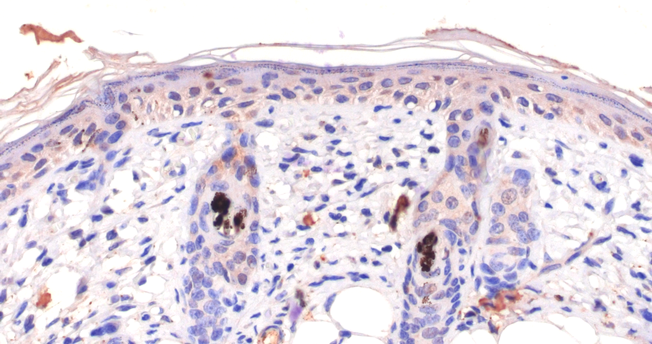 Uncovering How Cells Sense Oxygen Levels