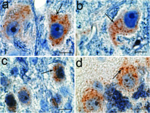 Parkinsons-Gene-Neurons