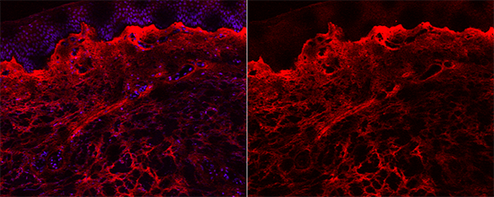 Mechanism Behind Chronic Fibrosis Discovered