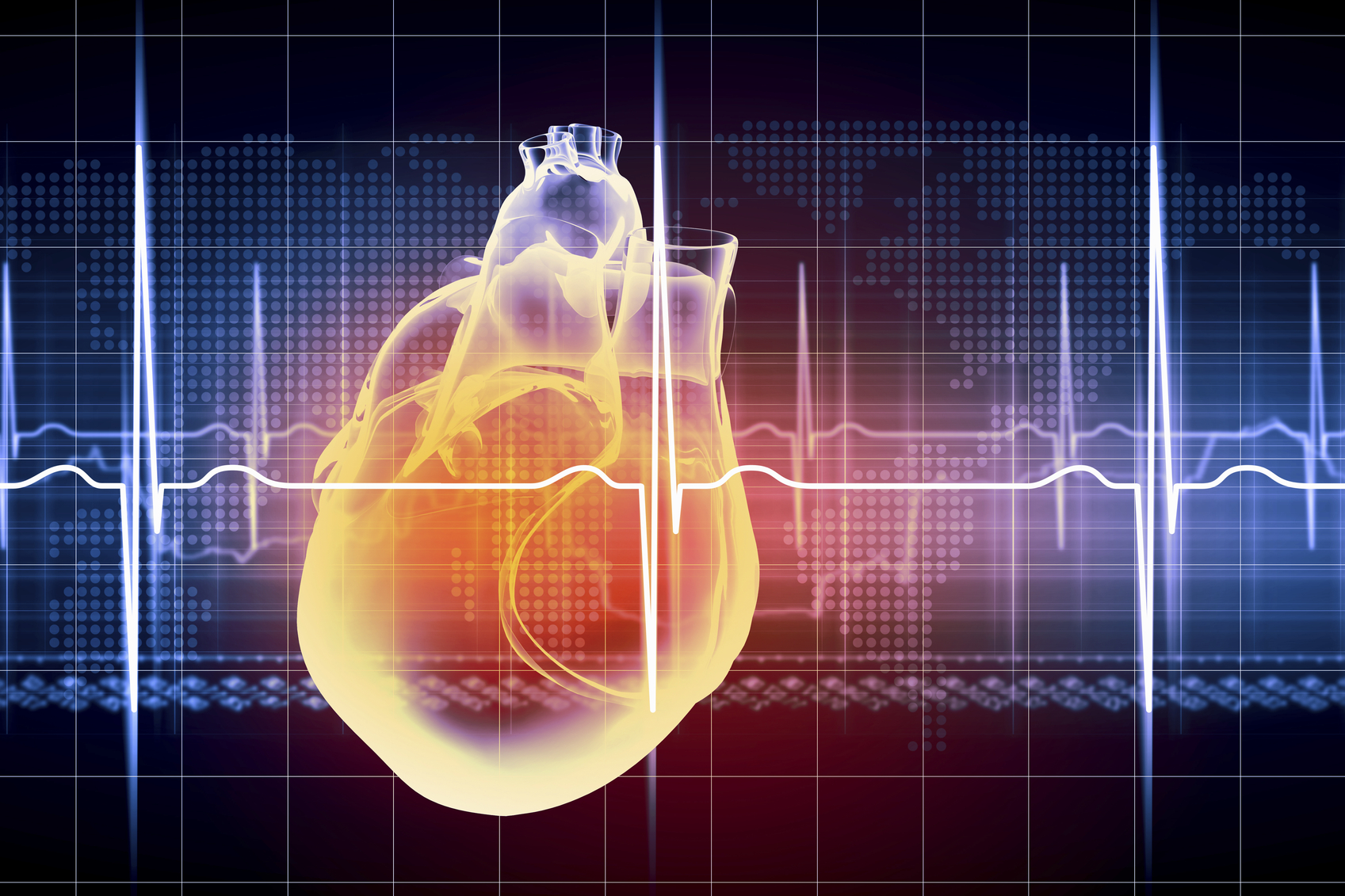 Noninvasive Imaging Predicts Risk of Heart Transplant Rejection