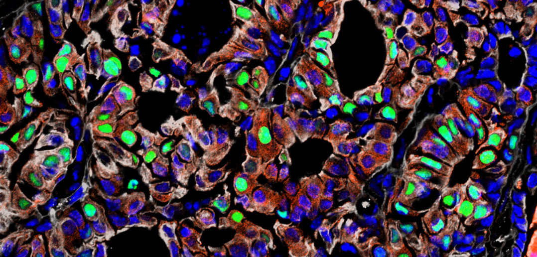 Scientists used lineage tracing to mark a specific cell, so as it divided new cells would retain the same color. Tracing this cell ancestry allows scientists to see how cells behave, if they mutate to cancerous forms and if so, what types of cancer. 