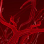 Predicting Risk of Blood Clots in Brain Tumors